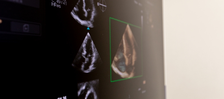 専門的な3D心エコー検査